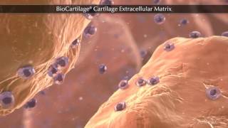 BioCartilage® Cartilage Extracellular Matrix [upl. by Aynek]