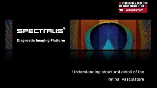 OCT Angiography Understanding the Structural Detail of the Retinal Vasculature [upl. by Natsrik]