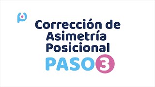 Corrección de Plagiocefalia  Paso 3 Tratamiento [upl. by Eserehs]