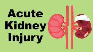 Acute Kidney Injury AKI  causes and management [upl. by Aw]