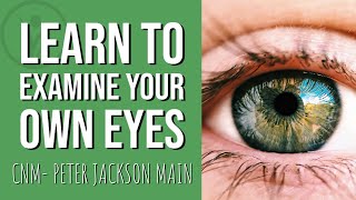 How To Perform Iridology On Yourself  CNM lecturer Peter Jackson Main [upl. by Sosthena]