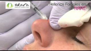 RELLENOS FACIALES  Okara Medicina Estética Láser [upl. by Nalehp132]