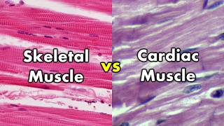 Differentiating Skeletal Muscle and Cardiac Muscle  Striations vs Intercalated Discs [upl. by Oneida]