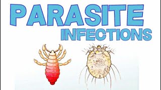 HUMAN PARASITE INFECTIONS  TYPES DIAGNOSIS AND TREATMENT [upl. by Fita549]