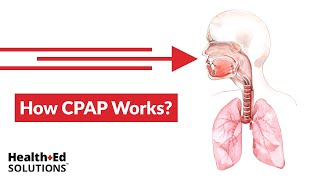 One Quick Question How Does CPAP Work [upl. by Lu654]