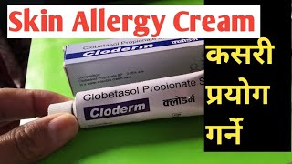 छाला चिलाएमा लगाउने मलमCream for Skin allergyMedicine for itching skincream for dermatitis [upl. by Trinl536]