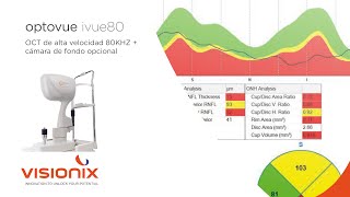 Optovue iVue80  ES [upl. by Valenba]