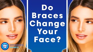 Do Braces Change Your Face  The Impact Of Braces On Your Jawline amp Face Shape [upl. by Ymaral]