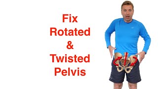 Best Rotated Pelvis Correction Exercises [upl. by Lakym5]