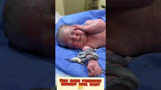 New born baby outside womb umbilical cord just after birth🫶🤰babygirl babyshorts viralreels [upl. by Sinnelg832]