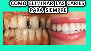 COMO ELIMINAR LAS CARIES PARA SIEMPRE  DIENTES SANO CON REMEDIO CASERO [upl. by Einnod]