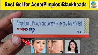 Minoz BPO Gel Use in Hindi  Minoz BPO Gel Benefits Side effects  Acne  Blackheads  SK Medicine [upl. by Gratianna]