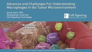 Advances and Challenges for Understanding Macrophages in the Tumor Microenvironment [upl. by Nivak987]