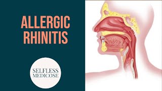 ALLERGIC RHINITIS complete explanation part 2 [upl. by Krasnoff]