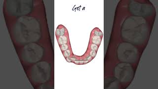 Visualise Orthodontic Consultation Best Orthodontist near you [upl. by Nigam]