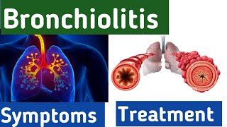 Bronchiolitis breathing  bronchiolitis cough symptoms causes diagnosis and treatment bronchitis [upl. by Jodee]