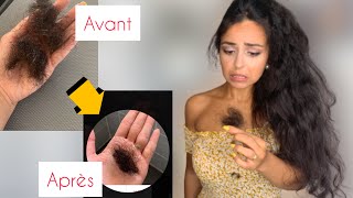 🧅Les bienfaits doignon sur les cheveux Traitement naturel contre la chute des cheveux🧅Remèdes GM [upl. by Mccafferty542]