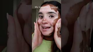 Part 2 ♥️ vitiligo makeup makeuptutorial beautymakeup tutorial beauty beautymakeup [upl. by Meehsar]