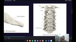 Anatomi Vertebrae dan Musculi Regio Dorsum [upl. by Prosper]