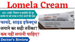 Lomela Cream Lomela Cream Ke fayde Aur Nuksan  Lomela Cream Review Lomela Cream How To Use [upl. by Georgeta]