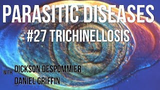 Parasitic Diseases Lectures 27 Trichinellosis [upl. by Isdnyl]