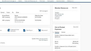 How to view your out of pocket expenses [upl. by Odlawso808]