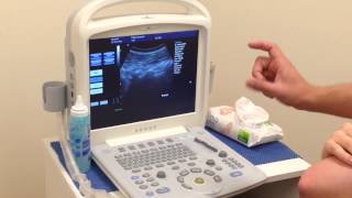 Real Time Ultrasound Rehabilitation of Multifidus [upl. by Angie996]