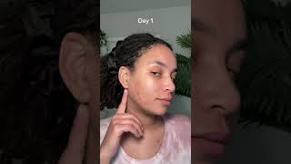 14 Day Skin Success Challenge Walmart [upl. by Nolava]