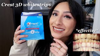 I tried the crest 3D whitestrips for 14 days effective 2023 [upl. by Adyl536]