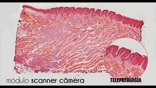 Telepatologia  Modulo scanner câmera  Sistema software [upl. by Lavro]