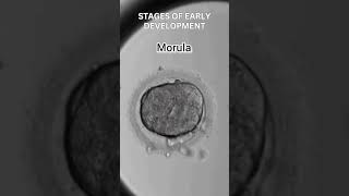 Early development of human  Cleavage  morula  blastulation [upl. by Nniuq]