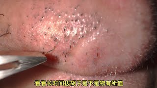 用新买的镊子拔胡子Plucking beard with newly bought tweezers [upl. by Nichola]