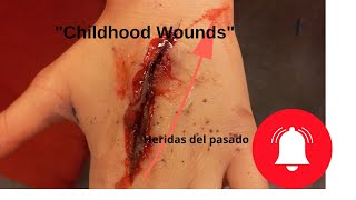 🔔Como sano mis heridas de mi infancia transgeneracional o de vidas pasadas [upl. by Jania62]