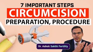 7 Important Steps Circumcision Prepraration Procedure [upl. by Nisay]