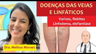 Problemas nas veias e linfáticos varizes tromboses feridas e erisipela Sintomas e tratamento [upl. by Anivlis]