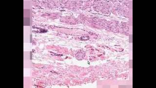 Shotgun Histology GastroEsophageal Junction [upl. by Lainad391]