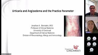 Urticaria and Angioedema Bernstein [upl. by Akemrej]