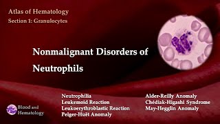 Nonmalignant Disorders of Neutrophils [upl. by Eirallam228]