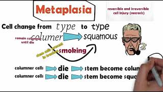 Metaplasia [upl. by Darn]