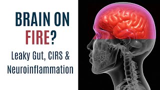 Is your brain on FIRE Neuroinflammation Leaky Gut and CIRS [upl. by Ennovart244]