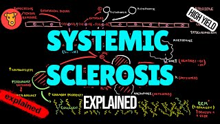 SCLERODERMA Systemic sclerosis Pathogenesis Diagnostic criteria Classification EULAR Treatment [upl. by Doble698]