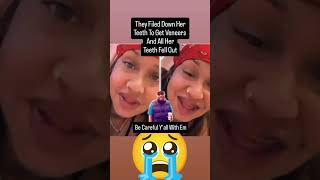 Veneers Denture Went Wrong hiphop wshh hiphopculture hiphopsociety 40club [upl. by Neelyt]