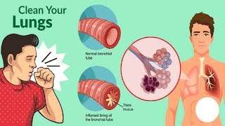 1 Device to Clear Out Mucus in Lungs shorts [upl. by Cykana]