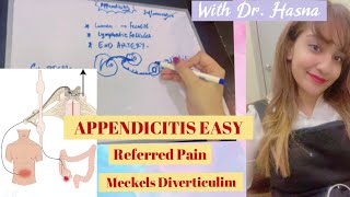 Appendicitis BEST CONCEPT  Referred Pain  Meckels diverticulitis anatomy appendix [upl. by Refanej]