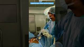 Laparoscopic colon cancer  dr Amit Acharya  Billroth Gastrosurgery centre Rajkot [upl. by Photima]