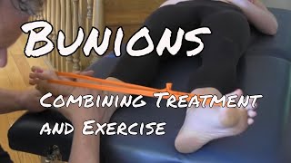 Bunions  Treatment and Exercise [upl. by Eiramanitsirhc302]