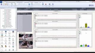 EMG Data Readings  Spinal Cord Injury [upl. by Silsbye]