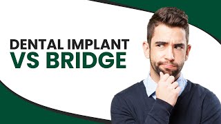 Dental Implant vs Bridge [upl. by Atteloj]