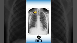 🔻 Anatomie VS Radiologie [upl. by Farland662]