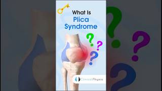 Plica Syndrome physiotherapy physicaltherapy knee kneepain [upl. by Inol]